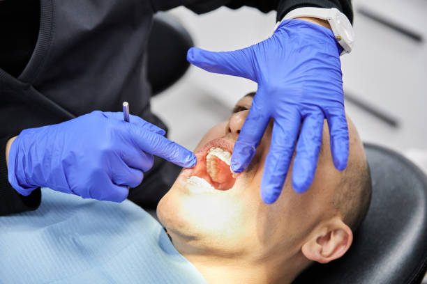 Best Emergency Dental Care for Broken or Chipped Teeth in Harahan, LA